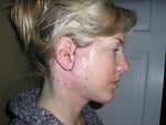 After. Look at that neck! See how small the sutures are.